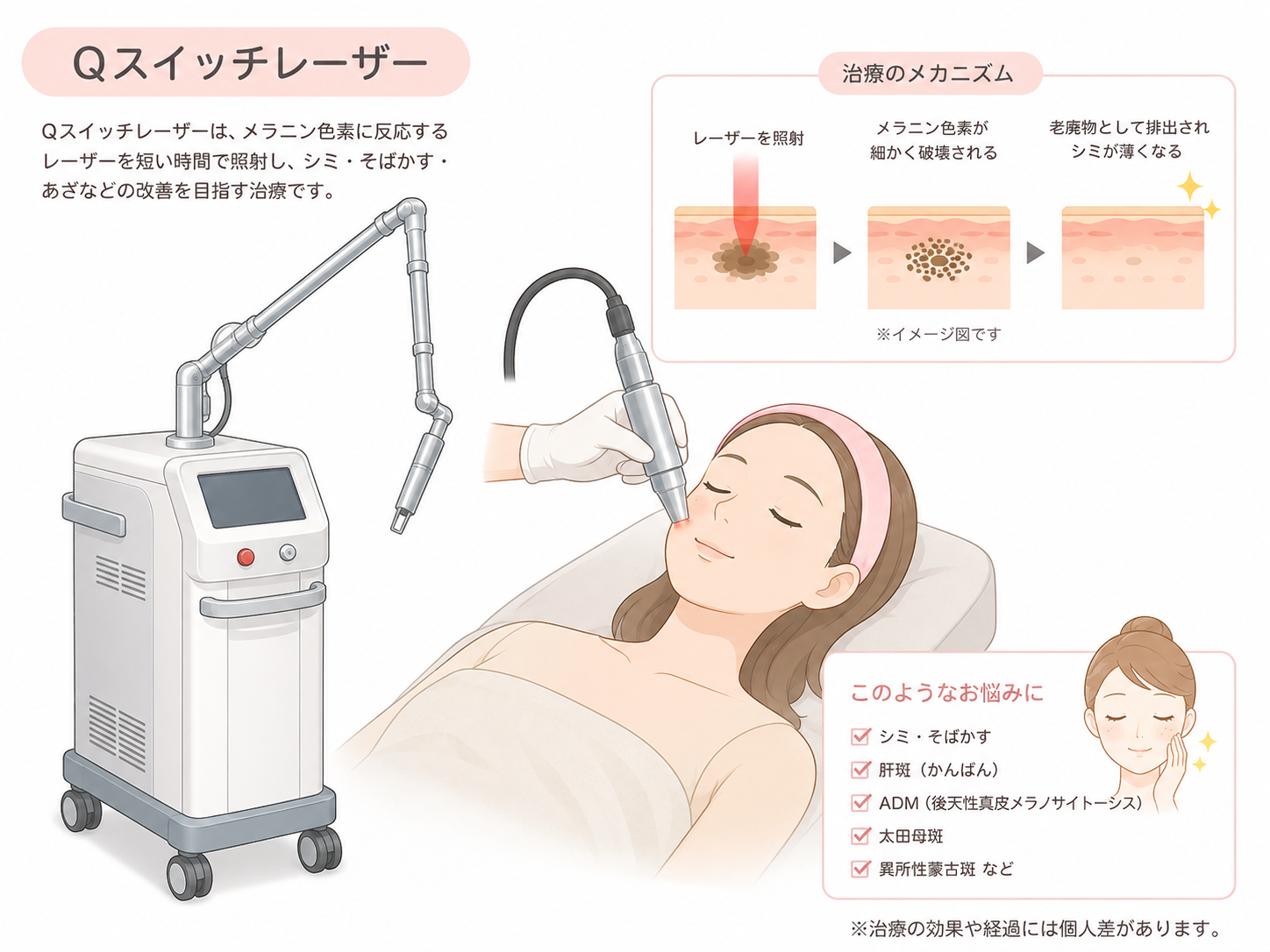 菊川周辺でQスイッチレーザーを相談したい方へ|菊川皮膚科・消化器内科クリニック
